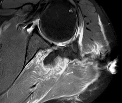 Figure 2 for case Stab wound